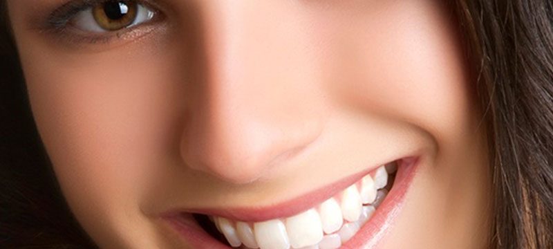 Porcelain Crowns (Caps) Discover Dental