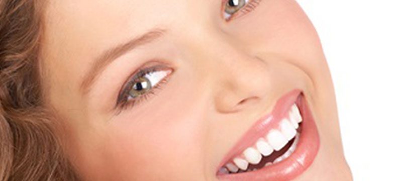 Crowns (Caps) Discover Dental
