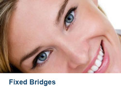 17-Fixed-Bridges