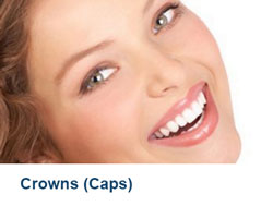19-Crowns-(Caps)